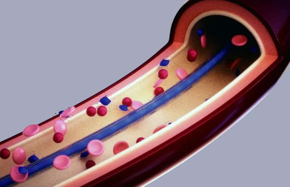 SILVERMARS Phosphorylcholine Coating Product Introduction