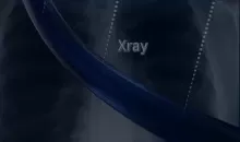 XaySirius® Medical Radiopaque Coating Series